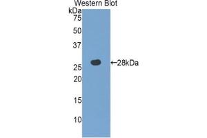 Western blot analysis of the recombinant protein. (MPST Antikörper  (AA 68-278))