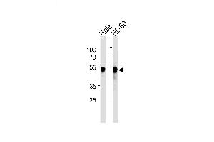 Lane 1: HeLa Cell lysates, Lane 2: HL-60Cell lysates, probed with VRK1 (1015CT2. (VRK1 Antikörper)