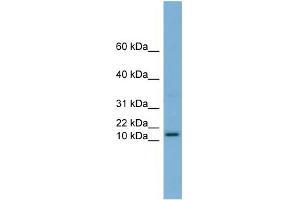 WB Suggested Anti-HRK Antibody Titration:  0. (HRK Antikörper  (N-Term))