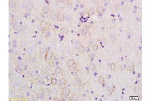 Formalin-fixed and paraffin embedded rat brain tissue labeled with Anti-APOE3 Polyclonal Antibody, Unconjugated (ABIN708761) at 1:200 followed by conjugation to the secondary antibody (APOE Antikörper  (AA 101-180))