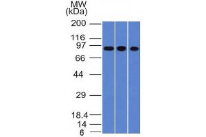 Western Blot of A549, HepG2 & HCT116 cell lysates with Villin Monoclonal Antibody (VIL1/1314). (Villin 1 Antikörper  (AA 179-311))