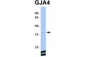 Host:  Rabbit  Target Name:  GJA4  Sample Type:  MCF7  Antibody Dilution:  1. (GJA4 Antikörper  (Middle Region))