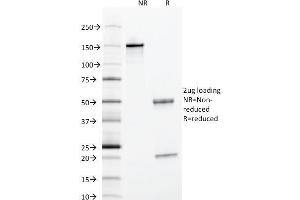 SDS-PAGE Analysis Purified Alpha-1-Antitrypsin Mouse Monoclonal Antibody (AAT/1378). (SERPINA1 Antikörper)