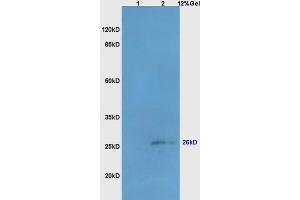 Lane 1: mouse liver lysates Lane 2: mouse brain lysates probed with Anti Bcl-10/CLAP/CIPER Polyclonal Antibody, Unconjugated (ABIN749828) at 1:200 in 4 °C. (BCL10 Antikörper  (AA 81-180))