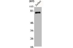 Western Blot analysis of Jurkat cells using Adducin β Polyclonal Antibody (ADD2 Antikörper  (Internal Region))