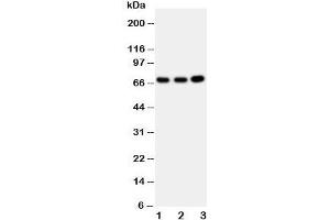 Western blot testing of GBP1 antibody and Lane 1:  U87;  2: HeLa;  3: MCF-7 cell lysate (GBP1 Antikörper  (AA 566-589))