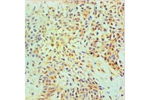 Immunohistochemical of paraffin-embedded Human Breast tissue using ABIN7144345 at dilution of 1:200. (Annexin A2 Antikörper)