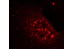 Immunofluorescence staining of methanol-fixed Hela cells showing nuclear dot staining using Phospho-AKT1-T308 antibody. (AKT1 Antikörper  (pThr308))