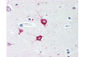 Anti-TOLLIP antibody IHC of human brain, cortex. (TOLLIP Antikörper  (C-Term))
