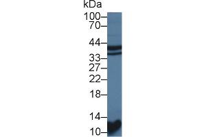 Western blot analysis of Rat Kidney lysate, using Rat STAP1 Antibody (1 µg/ml) and HRP-conjugated Goat Anti-Rabbit antibody ( (STAP1 Antikörper  (AA 1-297))