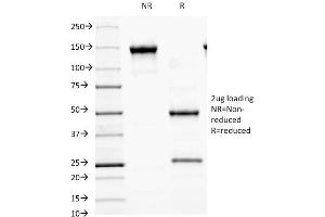 SDS-PAGE Analysis Purified MALT1 Mouse Monoclonal Antibody (MT1/410). (MALT1 Antikörper  (AA 701-808))