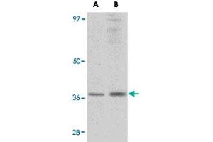 Western blot analysis of RSPO1 in rat spleen tissue lysate with RSPO1 polyclonal antibody  at (A) 1 and (B) 2 ug/mL . (RSPO1 Antikörper  (N-Term))