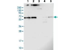 Western blot analysis of Lane 1: RT-4, Lane 2: U-251 MG, Lane 3: Human Plasma, Lane 4: Liver, Lane 5: Tonsil with CCDC125 polyclonal antibody .
