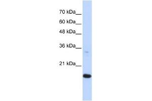 GABARAPL1 antibody used at 1 ug/ml to detect target protein. (GABARAPL1 Antikörper)