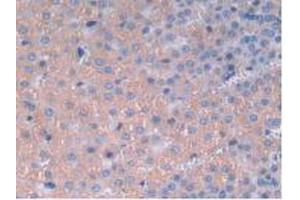 IHC-P analysis of Rat Adrenal Gland Tissue, with DAB staining. (IL12A Antikörper  (AA 23-215))