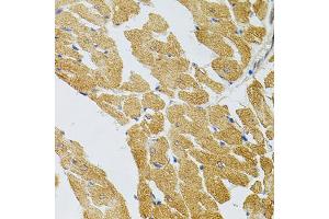 Immunohistochemistry of paraffin-embedded rat heart using SYK Antibody (ABIN5971150) at dilution of 1/100 (40x lens). (SYK Antikörper)
