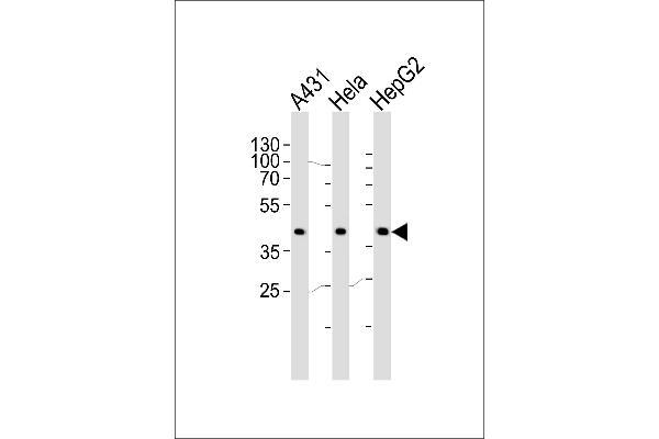 CSNK2A1/CK II alpha Antikörper  (AA 250-284)
