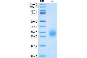 SDS-PAGE (SDS) image for Plasminogen Activator, Urokinase Receptor (PLAUR) (AA 214-305) protein (His tag) (ABIN7275404)