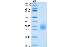 Human uPAR Domain 3 on Tris-Bis PAGE under reduced condition. (PLAUR Protein (AA 214-305) (His tag))