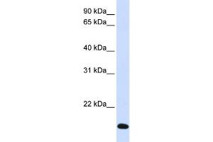 WB Suggested Anti-RNF185 Antibody Titration:  0. (RNF185 Antikörper  (Middle Region))