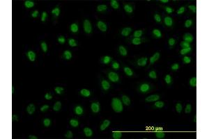 Immunofluorescence of monoclonal antibody to ZNF143 on HeLa cell.