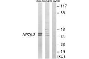 Western blot analysis of extracts from HuvEc/COLO cells, using APOL2 Antibody. (Apolipoprotein L 2 Antikörper  (AA 191-240))