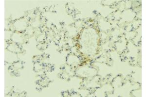 ABIN6268893 at 1/100 staining Human lung tissue by IHC-P. (Integrin beta 4 Antikörper  (C-Term))