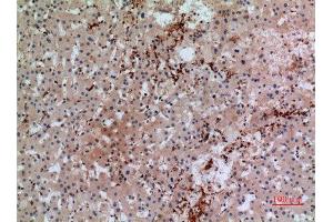 Immunohistochemistry (IHC) analysis of paraffin-embedded Human Liver, antibody was diluted at 1:100.