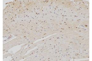 ABIN6259132 and ABIN6273372 at 1/100 staining Rat heart tissue by IHC-P. (NOC4L Antikörper  (Internal Region))