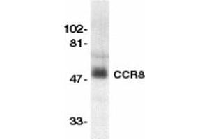 Image no. 1 for anti-Chemokine (C-C Motif) Receptor 8 (CCR8) (AA 183-201) antibody (ABIN201969) (CCR8 Antikörper  (AA 183-201))