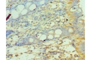 Immunohistochemistry of paraffin-embedded human colon tissue using ABIN7159067 at dilution of 1:100 (MMP14 Antikörper  (AA 260-540))