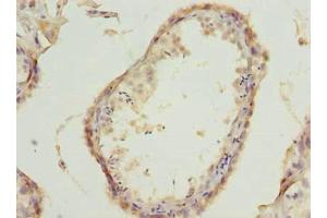 Immunohistochemistry of paraffin-embedded human testis tissue using ABIN7175778 at dilution of 1:100 (WDR61 Antikörper  (AA 2-305))