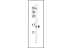 Western blot analysis of KCE1L Antibody (Center) (ABIN653619 and ABIN2842976) in NCI- cell line lysates (35 μg/lane).