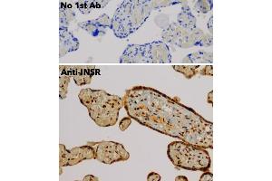 Immunohistochemistry (IHC) image for anti-Insulin Receptor (INSR) (C-Term) antibody (ABIN6254165)