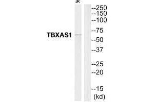 Western blot analysis of extracts from Jurkat cells, using THAS antibody. (TBXAS1 Antikörper  (C-Term))