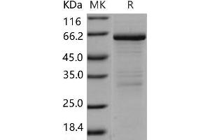 Western Blotting (WB) image for Matrix Metallopeptidase 8 (Neutrophil Collagenase) (MMP8) protein (ABIN7196954) (MMP8 Protein)