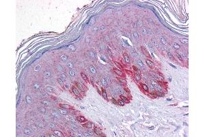 Immunohistochemistry (IHC) image for anti-EF-Hand Calcium Binding Domain 4A (EFCAB4A) (Internal Region) antibody (ABIN625991)