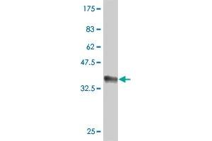 Western Blot detection against Immunogen (38. (LMX1B Antikörper  (AA 1-110))