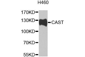 Western blot analysis of extracts of H460 cells, using CAST antibody (ABIN2650901) at 1:1000 dilution.