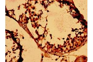 Immunohistochemistry (IHC) image for anti-Histone H2B Type 1-K (HIST1H2BK) (AA 2-126) antibody (ABIN7155403)