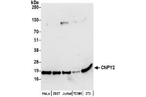 anti-Canopy 2 Homolog (CNPY2) (AA 1-50) antibody
