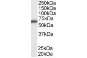 Image no. 1 for anti-DEAD (Asp-Glu-Ala-Asp) Box Polypeptide 5 (DDX5) (C-Term) antibody (ABIN374414) (DDX5 Antikörper  (C-Term))