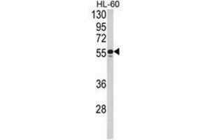 Western blot analysis of NR1H2 Antibody (N-term) in HL-60 cell line lysates (35ug/lane). (NR1H2 Antikörper  (N-Term))
