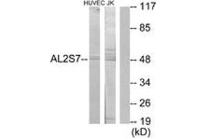 Western blot analysis of extracts from Jurkat/HuvEc cells, using AL2S7 Antibody. (Cyclin-Dependent Kinase 15 (ALS2CR7) (AA 261-310) Antikörper)