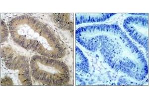 Immunohistochemistry (IHC) image for anti-conserved Helix-Loop-Helix Ubiquitous Kinase (CHUK) (pThr23) antibody (ABIN2888444) (IKK alpha Antikörper  (pThr23))