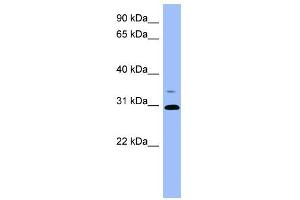 WB Suggested Anti-PSPH Antibody Titration: 0. (PSPH Antikörper  (Middle Region))