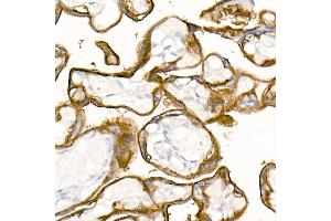 Immunohistochemistry of paraffin-embedded Human placenta using TROP-2 antibody (ABIN7271103) at dilution of 1:2700 (40x lens). (TACSTD2 Antikörper)