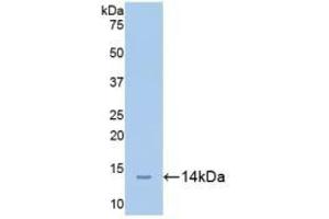 Detection of Recombinant CEACAM1, Mouse using Polyclonal Antibody to Carcinoembryonic Antigen Related Cell Adhesion Molecule 1 (CEACAM1) (CEACAM1 Antikörper  (AA 35-143))