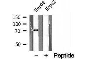 Western blot analysis of extracts of HepG2 cells, using ERp72 antibody. (PDIA4 Antikörper  (Internal Region))