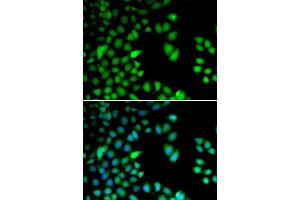 Immunofluorescence (IF) image for anti-Ribosomal Protein S6 Kinase, 90kDa, Polypeptide 3 (RPS6KA3) antibody (ABIN1876624) (RPS6KA3 Antikörper)